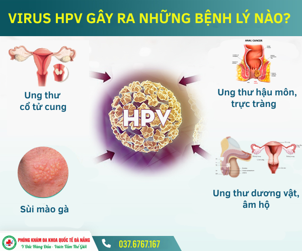 víu HPV gây ra bệnh lý gì