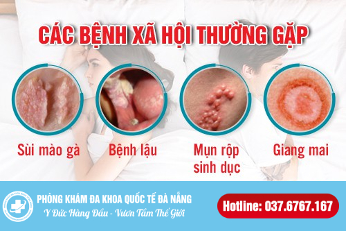 các bệnh xã hội đà nẵng