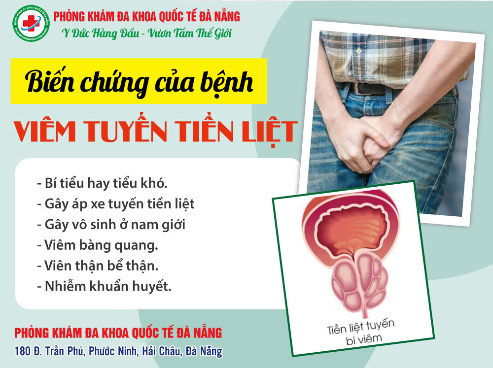 triệu chứng viêm tuyến tiền liệt