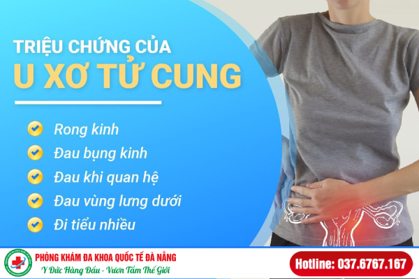 đau bụng dưới do u xơ tử cung