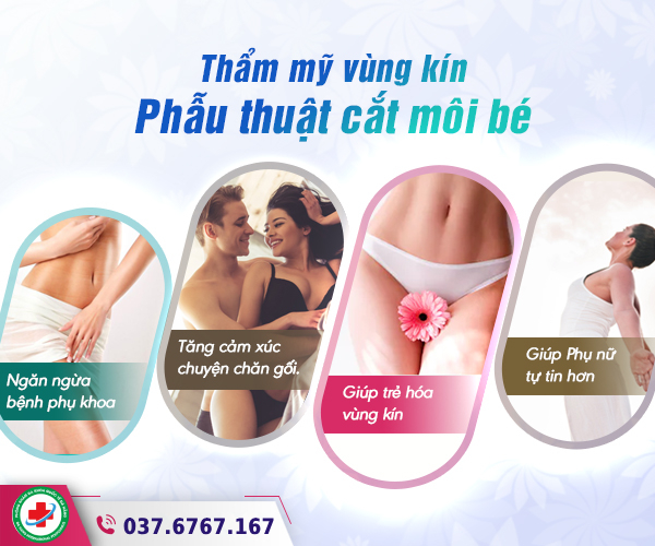 lợi ích cắt môi bé