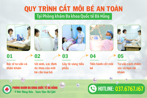 quy trình cắt môi bé tại phòng khám