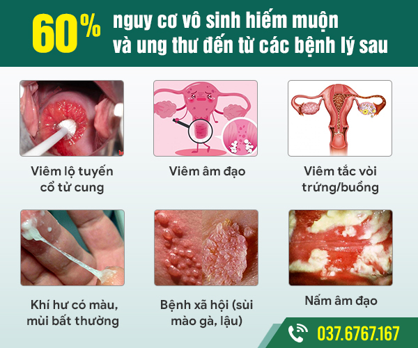 tại sao nên đi khám phụ khoa