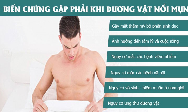 dương vật nổi mụn có nguy hiểm không