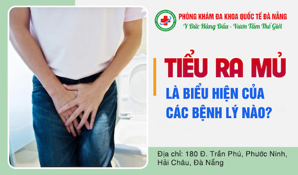 nguyên nhân tiểu ra mủ là gì