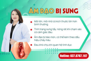 âm đạo bị sưng là bệnh gì