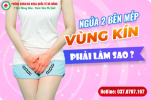 ngứa 2 bên mép vùng kín là bệnh gì